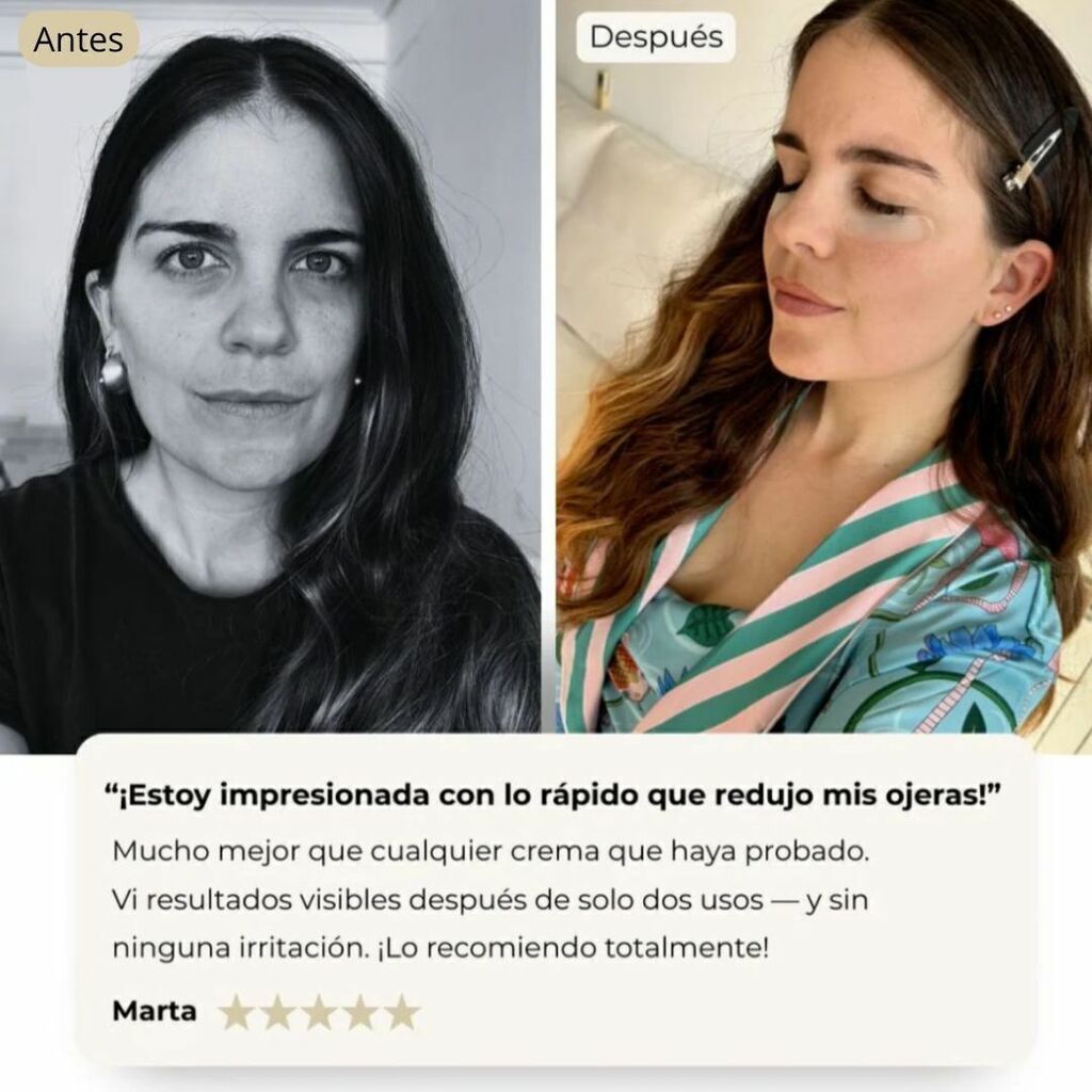 PARCHES CONTORNO DE OJOS